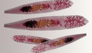 Opisthorchis parasites in the human body