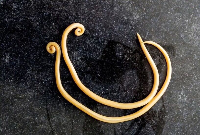 Roundworms are the most common parasite of the human body