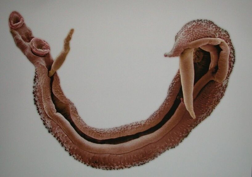 Schistosomes - a dangerous parasite in human blood