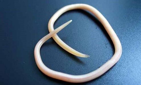 worm parasite from the human body