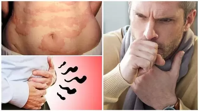 Allergies, cough and bloating are signs of damage to the body by worms